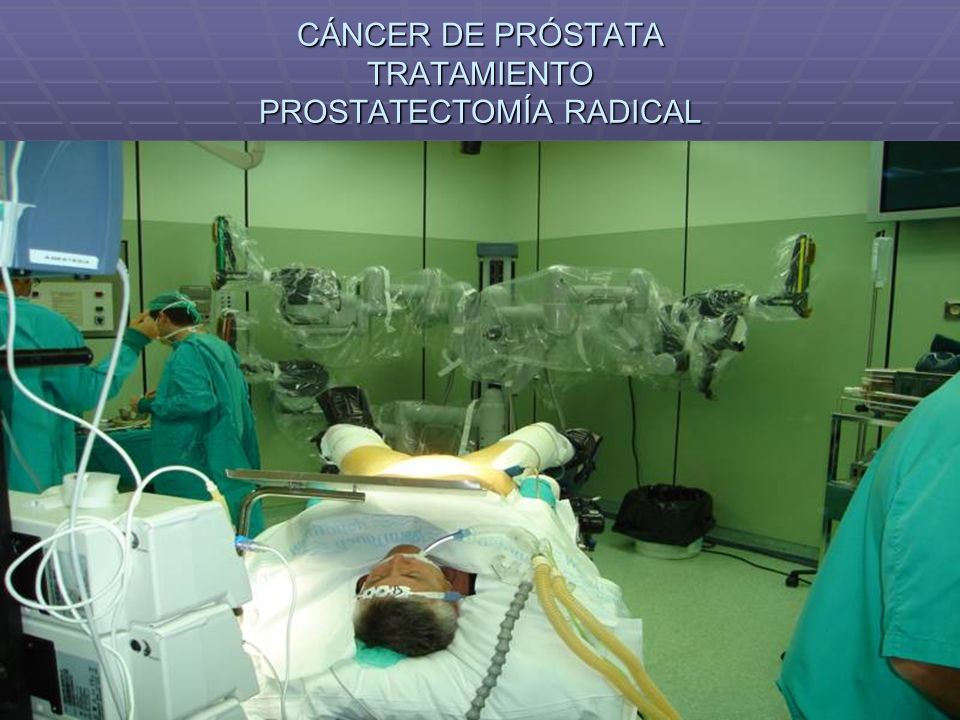 después de la prostatectomía radical examen de sanatorio de próstata